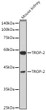Western blot analysis of lysates from Mouse kidney, using TROP-2 Rabbit pAb (STJ11103619) at 1:1000 dilution. <br/>Secondary antibody: HRP-conjugated Goat anti-Rabbit IgG (H+L) (STJS000856) at 1:10000 dilution. <br/>Lysates/proteins: 25 Mu g per lane. <br/>Blocking buffer: 3% nonfat dry milk in TBST. <br/>Detection: ECL Basic Kit <br/>Exposure time: 10s.