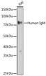 Western blot analysis of lysates from Raji cells, using Human IgM Rabbit pAb (STJ11103627) at 1:500 dilution. <br/>Secondary antibody: HRP-conjugated Goat anti-Rabbit IgG (H+L) (STJS000856) at 1:10000 dilution. <br/>Lysates/proteins: 25 Mu g per lane. <br/>Blocking buffer: 3% nonfat dry milk in TBST. <br/>Detection: ECL Basic Kit <br/>Exposure time: 30s.