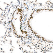 Immunohistochemistry analysis of paraffin-embedded Mouse lung tissue using FUBP1 Rabbit mAb  (STJ11103646) at a dilution of 1:200 (40x lens).  High pressure antigen retrieval was performed with 0. 01 M citrate buffer (pH 6. 0) prior to immunohistochemistry staining.