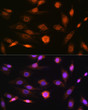 Western blot analysis of various lysates using CAMKIV Rabbit mAb (STJ11103655) at 1:1000 dilution. <br>Secondary antibody: HRP Goat Anti-Rabbit IgG (H+L) (STJS000856) at 1:10000 dilution. <br>Lysates/proteins: 25 Mu g per lane. <br>Blocking buffer: 3% nonfat dry milk in TBST. <br>Detection: ECL Basic Kit <br>Exposure time: 30s.