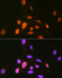 Immunofluorescence analysis of U-2 OS cells using CAMKIV Rabbit mAb (STJ11103655) at dilution of 1:100 (40x lens). Secondary antibody: Cy3 Goat Anti-Rabbit IgG (H+L) (STJS001166) at 1:500 dilution. Blue: DAPI for nuclear staining.