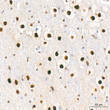 Immunohistochemistry analysis of CAMKIV in paraffin-embedded rat brain tissue using CAMKIV Rabbit mAb  (STJ11103655) at a dilution of 1:800 (40x lens).  High pressure antigen retrieval was performed with 0. 01 M citrate buffer (pH 6. 0) prior to immunohistochemistry staining.