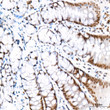 Immunohistochemistry analysis of CAMKIV in paraffin-embedded rat colon tissue using CAMKIV Rabbit mAb  (STJ11103655) at a dilution of 1:800 (40x lens).  High pressure antigen retrieval was performed with 0. 01 M citrate buffer (pH 6. 0) prior to immunohistochemistry staining.