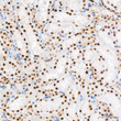 Immunohistochemistry analysis of CAMKIV in paraffin-embedded rat kidney tissue using CAMKIV Rabbit mAb  (STJ11103655) at a dilution of 1:800 (40x lens).  High pressure antigen retrieval was performed with 0. 01 M citrate buffer (pH 6. 0) prior to immunohistochemistry staining.