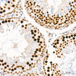 Immunohistochemistry analysis of CAMKIV in paraffin-embedded rat testis tissue using CAMKIV Rabbit mAb  (STJ11103655) at a dilution of 1:800 (40x lens).  High pressure antigen retrieval was performed with 0. 01 M citrate buffer (pH 6. 0) prior to immunohistochemistry staining.