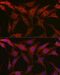 Immunofluorescence analysis of NIH-3T3 cells using Beta-Tubulin Rabbit pAb (STJ11103686) at dilution of 1:100 (40x lens). Secondary antibody: Cy3-conjugated Goat anti-Rabbit IgG (H+L) (STJS001166) at 1:500 dilution. Blue: DAPI for nuclear staining.
