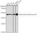 Western blot analysis of various lysates using Alpha-tubulin (ubiquitous) chain Rabbit pAb (STJ11103689) at 1:500 dilution. <br/>Secondary antibody: HRP-conjugated Goat anti-Rabbit IgG (H+L) (STJS000856) at 1:10000 dilution. <br/>Lysates/proteins: 25 Mu g per lane. <br/>Blocking buffer: 3% nonfat dry milk in TBST. <br/>Detection: ECL Basic Kit <br/>Exposure time: 1s.