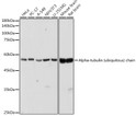 Western blot analysis of various lysates using Alpha-tubulin (ubiquitous) chain Rabbit pAb (STJ11103690) at 1:1000 dilution. <br/>Secondary antibody: HRP-conjugated Goat anti-Rabbit IgG (H+L) (STJS000856) at 1:10000 dilution. <br/>Lysates/proteins: 25 Mu g per lane. <br/>Blocking buffer: 3% nonfat dry milk in TBST. <br/>Detection: ECL Basic Kit <br/>Exposure time: 1s.