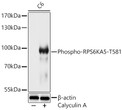 Western blot analysis of lysates from C6 cells using Phospho-RPS6KA5-T581 Rabbit pAb (STJ11103736) at1:1000 dilution. C6 cells were treated by Calyculin A (100 nM) at 37C for 30 minutes after serum-starvation overnight. <br>Secondary antibody: HRP-conjugated Goat anti-Rabbit IgG (H+L) (STJS000856) at 1:10000 dilution. <br>Lysates/proteins: 25  Mu g per lane. <br>Blocking buffer: 3% nonfat dry milk in TBST. <br>Detection: ECL Basic Kit <br>Exposure time: 60s.