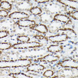 Immunohistochemistry analysis of paraffin-embedded Rat kidney using Phospho-FOXO3A-S425 Rabbit pAb (STJ11103738) at dilution of 1:200 (40x lens). High pressure antigen retrieval performed with 0. 01M Citrate Bufferr (pH 6. 0) prior to immunohistochemistry staining.