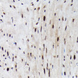 Immunohistochemistry analysis of paraffin-embedded Mouse heart using Phospho-FOXO3A-S425 Rabbit pAb (STJ11103738) at dilution of 1:200 (40x lens). High pressure antigen retrieval performed with 0. 01M Citrate Bufferr (pH 6. 0) prior to immunohistochemistry staining.