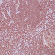 Formalin-fixed, paraffin-embedded human lymph node stained with anti-CD45 (LCA) antibody using peroxidase-conjugate and DAB chromogen. Note cell membrane staining of B-and T-lymphocytes.