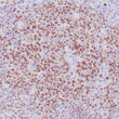 Formalin-fixed, paraffin-embedded human lymph node stained with anti-LMO2 antibody using peroxidase-conjugate and AEC chromogen. Note nuclear staining of germinal center cells