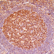 Anti-LMO-2 antibody IHC human lymph node STJ180579