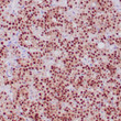 Formalin-fixed, paraffin-embedded human pituitary stained with anti-PIT-1 antibody using peroxidase-conjugate and DAB chromogen. Note strong nuclear staining of glandular cells