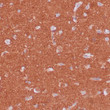 Anti-PGP9.5 antibody IHC human brain STJ180620