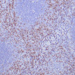 Formalin-Fixed, paraffin-embedded human tonsil stained with anti-ZAP-70 antibody using peroxidase-conjugate and DAB chromogen. Note the cytoplasmic staining of B cells