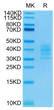 Biotunylated Human BCMA Trimer on Tris-Bis PAGE under reduced condition. The purity is greater than 95%.