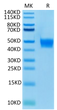 Biotinylated Human FGFR3 beta (IIIb) on Tris-Bis PAGE under reduced condition. The purity is greater than 95%.