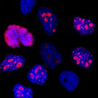 IHC staining Ki-67 labeling in nucleoli HeLa cellsred signal with blue DNA STJA0004900