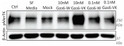 Western blot increased MerTK phosphorylation in THP-1 cells using antibody STJA0004902