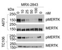 Western blot phosphorylated MERTK detection in A673 and TC106 cells using antibody  STJA0004902