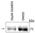 Western blot phosphorylated ATF2 protein at Thr52 in UACC903 melanoma cells STJA0003584