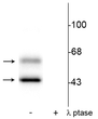 Western blot phospho-CaM Kinase II detection in rat brain lysate with phosphatase control STJA0003589