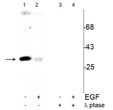 Western blot cdc2 Tyr15 phosphorylation in T47D cells with EGF and phosphatase controls STJA0003591