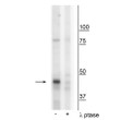 Western blot of mouse mitochondria from whole brain lysate showing specific immunolabeling of the ~46 kDa CK1Mt protein phosphorylated at Tyr153 in the first lane (-). Phosphospecificity is shown in the second lane (+) where the immunolabeling is greatly decreased by blot treatment with lambda phosphatase ( Lambda-Ptase, 1200 units for 30 minutes). Western blot of mouse mitochondria from whole brain lysate showing specific immunolabeling of the ~46 kDa CK1Mt protein phosphorylated at Tyr153 in the first lane (-). Phosphospecificity is shown in the second lane (+) where the immunolabeling is greatly decreased by blot treatment with lambda phosphatase ( Lambda-Ptase, 1200 units for 30 minutes).