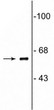 WB analysis 62 kDa COBRA1 protein detection in neonatal rat brain lysate STJA0003598