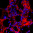 IHC staining fibrotic mouse lung tissue using antibody collagen I in red STJA0003600