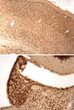 Immunolabeling of mouse cerebral cortex (top) and habenula (bottom) brain sections labeled with anti-phospho-ser133 CREB (STJA0003605, DAB, 1:100). These images were kindly provided by Dr. Anton Reiner, Univ. of Tennessee Health Science Center (Memphis, TN).