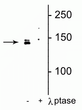 Western blot of HeLa cell lysate showing specific immunolabeling of the ~142 kDa DENND3 protein phosphorylated at Ser554 in the first lane (-). Phosphospecificity is shown in the second lane (+) where immunolabeling is completely eliminated by lysate treatment with lambda phosphatase ( Lambda-Ptase, 800 units/1mg protein for 30 min).