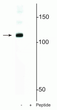 Western blot of mouse nuclei lysate showing specific immunolabeling of the ~120 kDa DGCR8 protein phosphorylated at in the first lane (-). Phosphospecificity is shown in the second lane (+) where immunolabeling is blocked by preadsorption of the phosphopeptide used as the antigen, but not by the corresponding non-phosphopeptide (not shown).