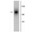 Western blot of human striatal lysate showing specific immunolabeling of the ~88 kDa DAT protein.