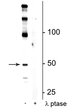 Western blot of mouse hippocampal lysate showing specific immunolabeling of the ~50 kDa eEF1A2 protein phosphorylated at Ser358 in the first lane (-). Phosphospecificity is shown in the second lane (+) where immunolabeling is completely eliminated by lysate treatment with lambda phosphatase ( Lambda-Ptase, 800 units/1mg protein for 30 min).