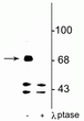 Western blot FMRP protein phosphorylated at Ser499 in rat hippocampal lysate STJA0003635