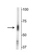Western blot 67 kDa GAT-2 protein immunolabeling in mouse brain lysate STJA0003655