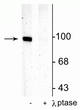 Western blot of rat hippocampal lysate showing specific immunolabeling of the ~100 kDa GluR1 protein phosphorylated at Ser831 in the first lane (-). Phosphospecificity is shown in the second lane (+) where immunolabeling is completely eliminated by blot treatment with lambda phosphatase ( Lambda-Ptase, 1200 units for 30 min).