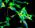 IHC staining SH-SY5Y cells using Anti-GAPDH antibody green with NF-H and DAPI STJA0003666