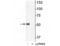 Western blot of mouse heart lysate showing specific immunolabeling of the ~55 kDa HDAC2 protein phosphorylated at Ser394 in the first lane (-). Phosphospecificity is shown in the second lane (+) where immunolabeling is completely eliminated by blot treatment with lambda phosphatase ( Lambda-Ptase, 1200 units for 30 min).