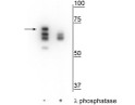 Western blot of T47D cell lysate treated with EGF (1 nM) for 60 minutes showing specific labeling of the ~70 kDa Hsp70 in the first lane (-). Phosphospecificity is shown in the second lane (+) where immunolabeling is eliminated or significantly decreased with lambda phosphatase ( Lambda-Ptase, 1200 units for 30 minutes).