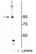 Western blot phosphorylated IR protein at Thr1160 in HeLa cell lysate with phosphatase control STJA0003672