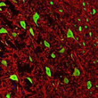 Anti-MAP2 antibody IHC staining rat brain stem section neuronal dendrites in red STJA0003676