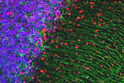 anti-MeCP2 IF staining rat cerebellum section with GFAP colocalization and DAPI STJA0003679