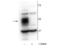Western blot MEF2C phospho-Ser222 detection in OCIAML2 lysate with phosphatase control STJA0003682