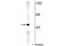 Western blot phosphorylated MEK5 protein at 49 kDa in rat testes lysate STJA0003686
