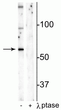 Western blot Munc18-1 phospho-Ser241 immunolabeling in mouse hippocampal lysate STJA0003693