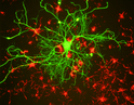 Immunostaining of mixed cultured rat neurons stained with anti-NFL antibody (STJA0003699, green, 1:100) and anti-alpha internexin.